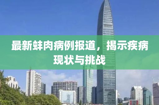 最新蚌肉病例报道，揭示疾病现状与挑战